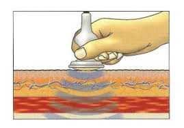 Deep oscillation دستگاه