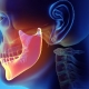 فیزیوتراپی مفصل فک صورت یا گیجگاهی یا TMJ